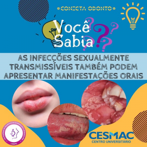 LADEPO- desenvolve- programação- da- semana- no- Projeto- Conecta- Odonto-_Odontologia_CESMAC (4)